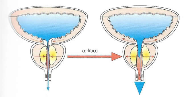 alfalitici funzionamento su prostata