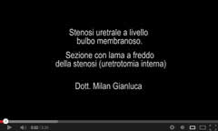 Stenosi uretrale bulbo membranoso Urologo Andrologo Milan
