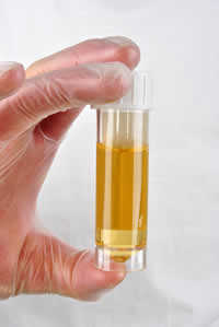 Ce ne dezvaluie urina despre starea noastra de sanatate