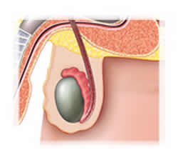 dimensione testicoli