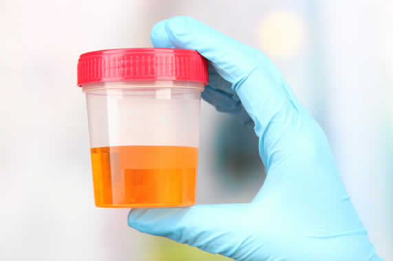 informazioni e curiosita urine