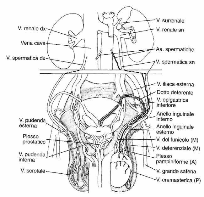 spiegazione varicocele