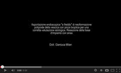 Asportazione endoscopica neoformazione polipoide vescica con pinza bioptica Urologo Andrologo Milan