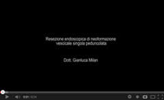 Resezione endoscopica neoformazione vescicale singola peduncolata Urologo Andrologo Milan