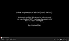 Sclerosi congenita del collo vescicale malattia di Marion Urologo Andrologo Milan